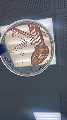 Chromogenic MRSA Agar Plate
