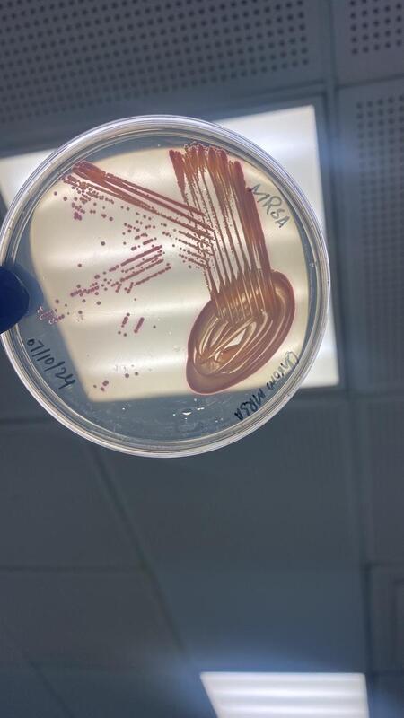 Chromogenic MRSA Agar Plate