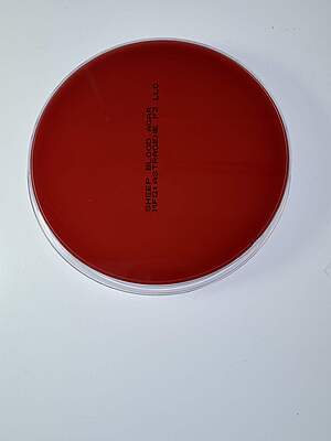 Blood Agar Plate (With 5 % Sheep Blood)- 10 plates