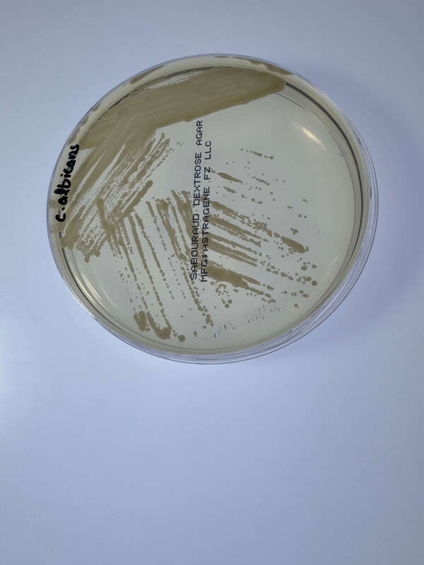 Sabouraud Dextrose Agar Plate